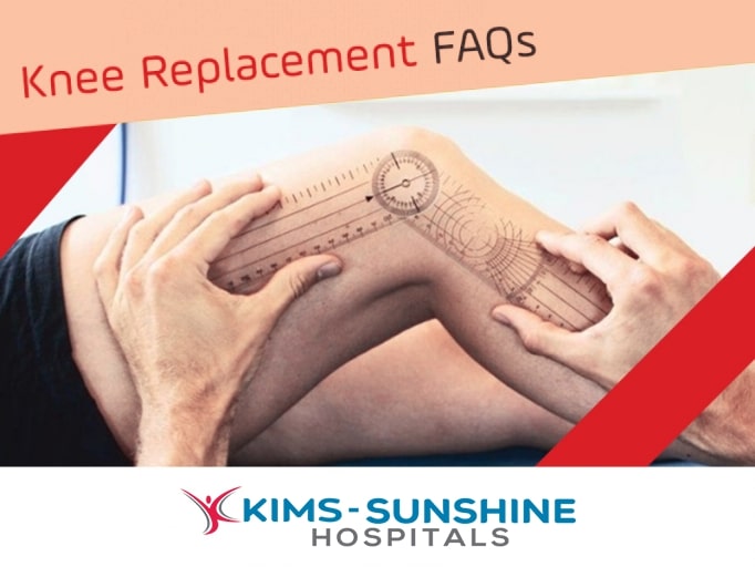 Questions Regarding Knee Replacement Surgery