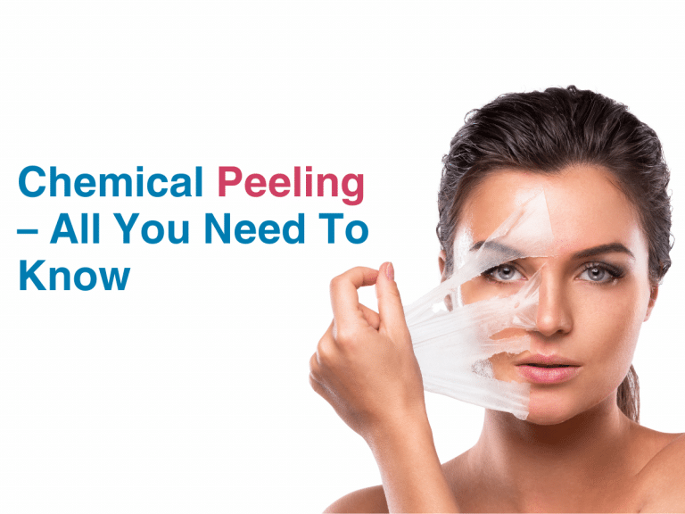 Unlock Radiant Skin: Comprehensive Guide to Chemical Peeling