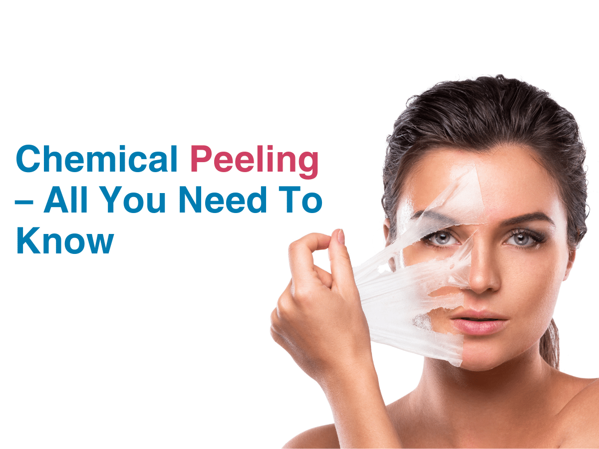 Chemical Peeling – All You Need To Know - Multispeciality Hospital