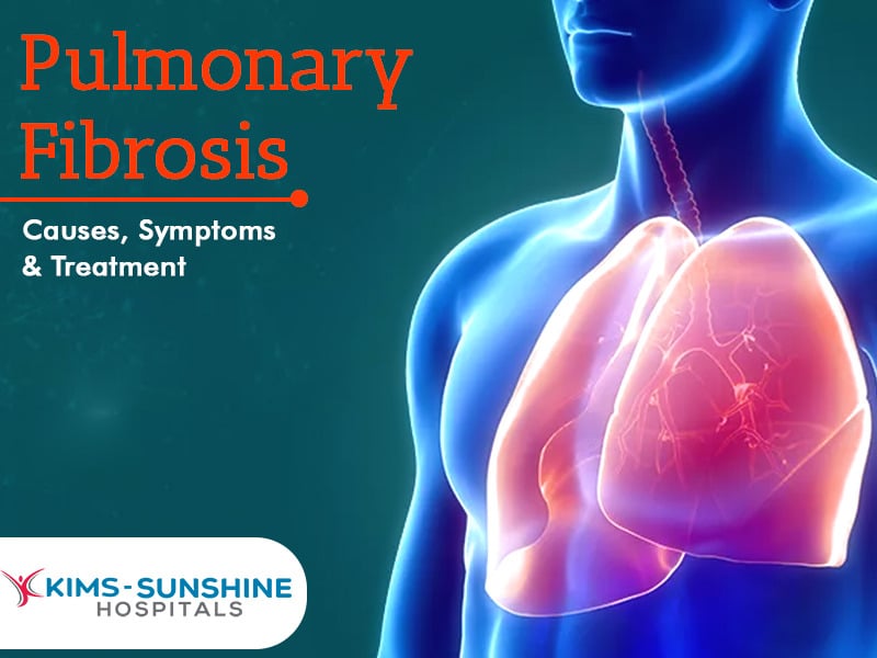 Pulmonary Fibrosis - Causes, Symptoms And Treatment - Multispeciality