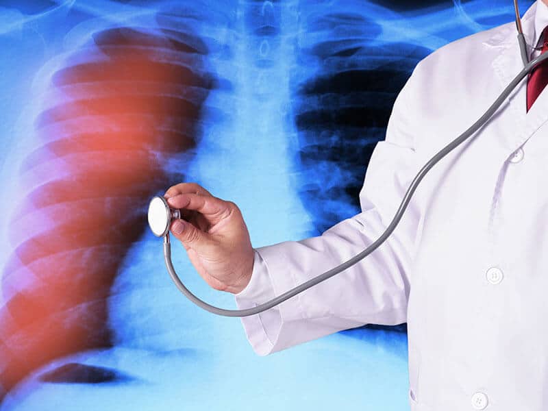 Treatment for respiratory system & sunshine hospitals