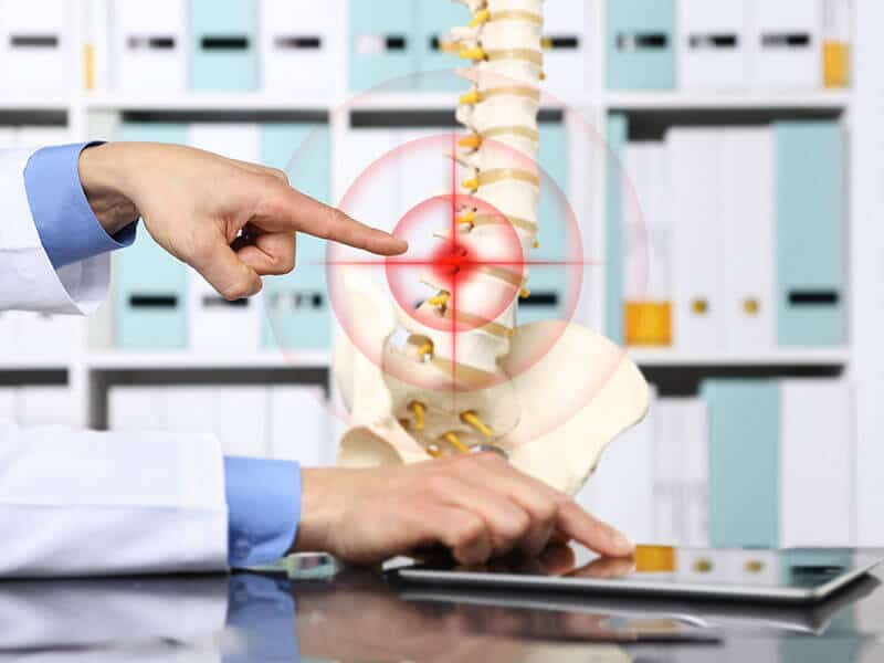 Best spine surgery in hyderabad