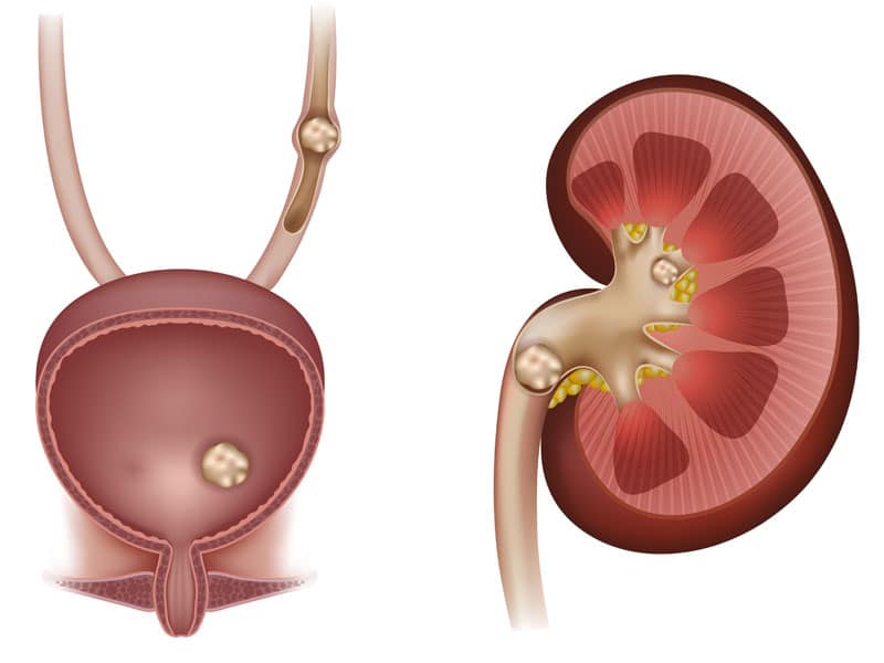 Urology