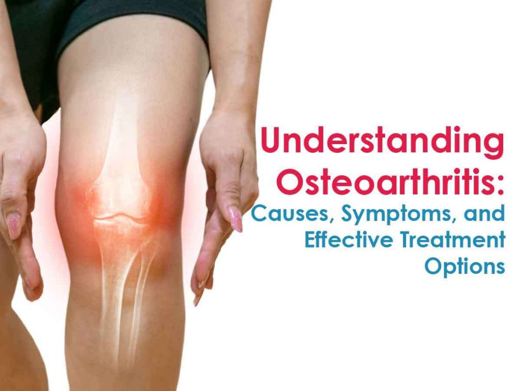 Osteoarthritis Symptoms & Treatment