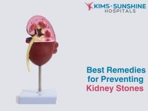 Best Remedies for Preventing Kidney Stones - Multispeciality Hospital