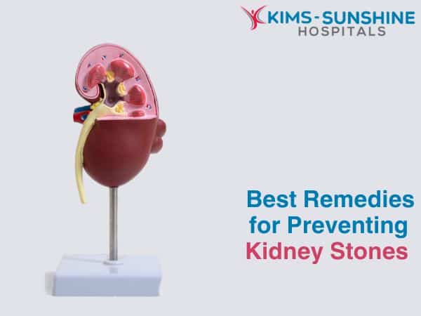 Dietary changes to prevent kidney stones naturally