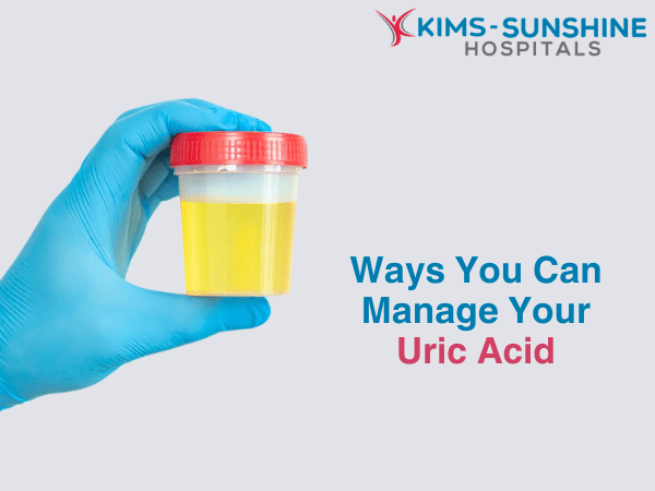 Effective home remedies for reducing uric acid