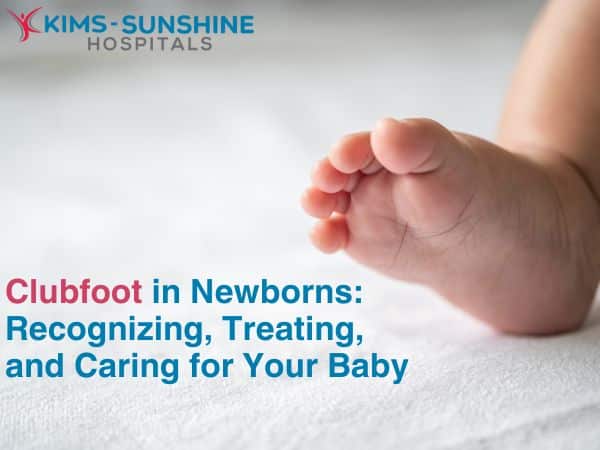 Non-surgical treatment options for clubfoot in infants