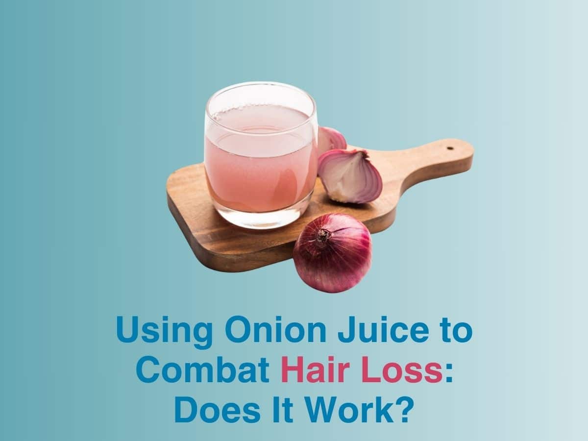 Using Onion Juice to Combat Hair Loss Does It Work Multispeciality Hospital