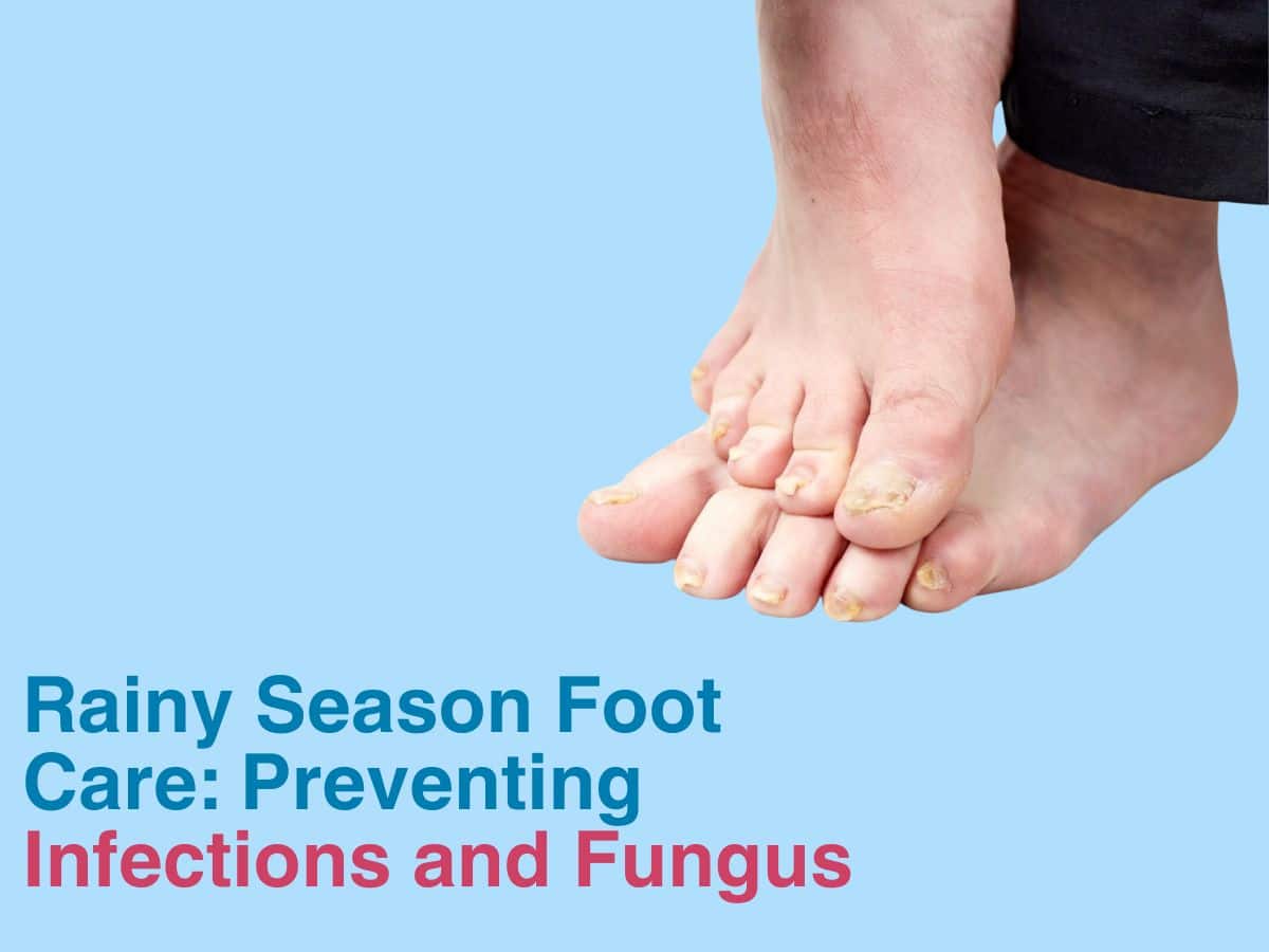 Rainy Season Foot Care: Preventing Infections and Fungus