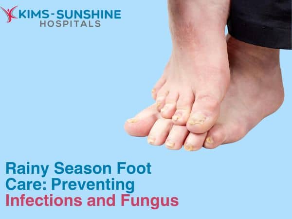 Rainy Season Foot Care: Preventing Infections and Fungus