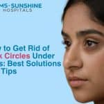 How to Get Rid of Dark Circles Under Eyes: Best Solutions and Tips