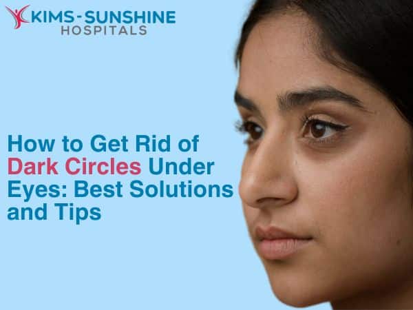 How to Get Rid of Dark Circles Under Eyes: Best Solutions and Tips