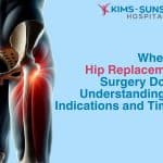 When is Hip Replacement Surgery Done? Understanding the Indications and Timing