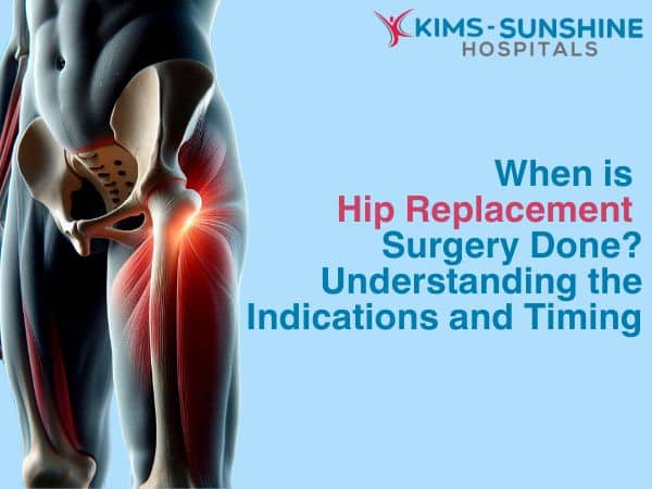 When is Hip Replacement Surgery Done? Understanding the Indications and Timing