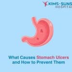 What Causes Stomach Ulcers and How to Prevent Them