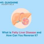 What is Fatty Liver Disease and How Can You Reverse It?