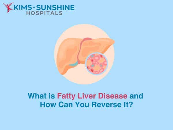 What is Fatty Liver Disease and How Can You Reverse It?