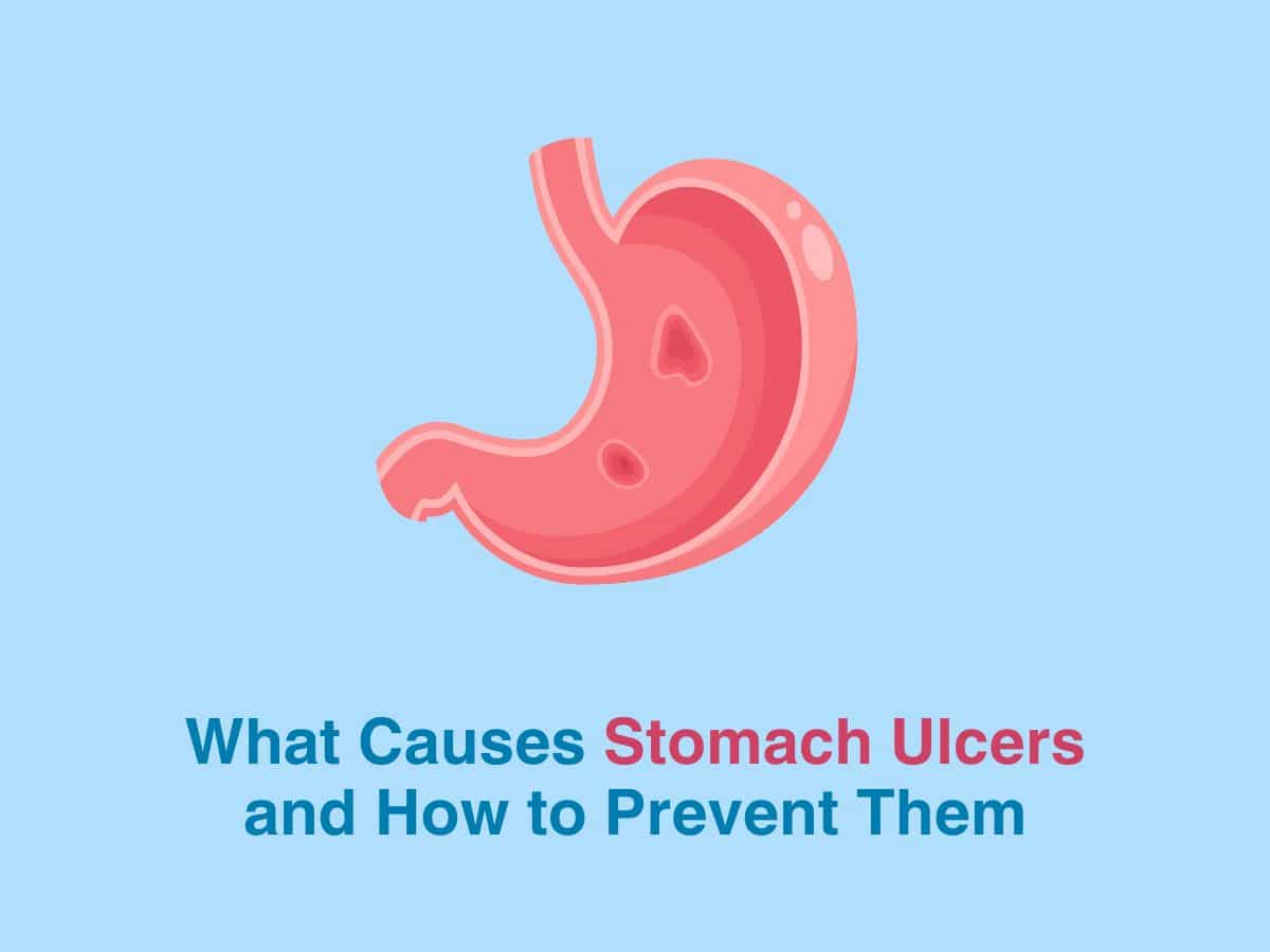 What Causes Stomach Ulcers and How to Prevent Them