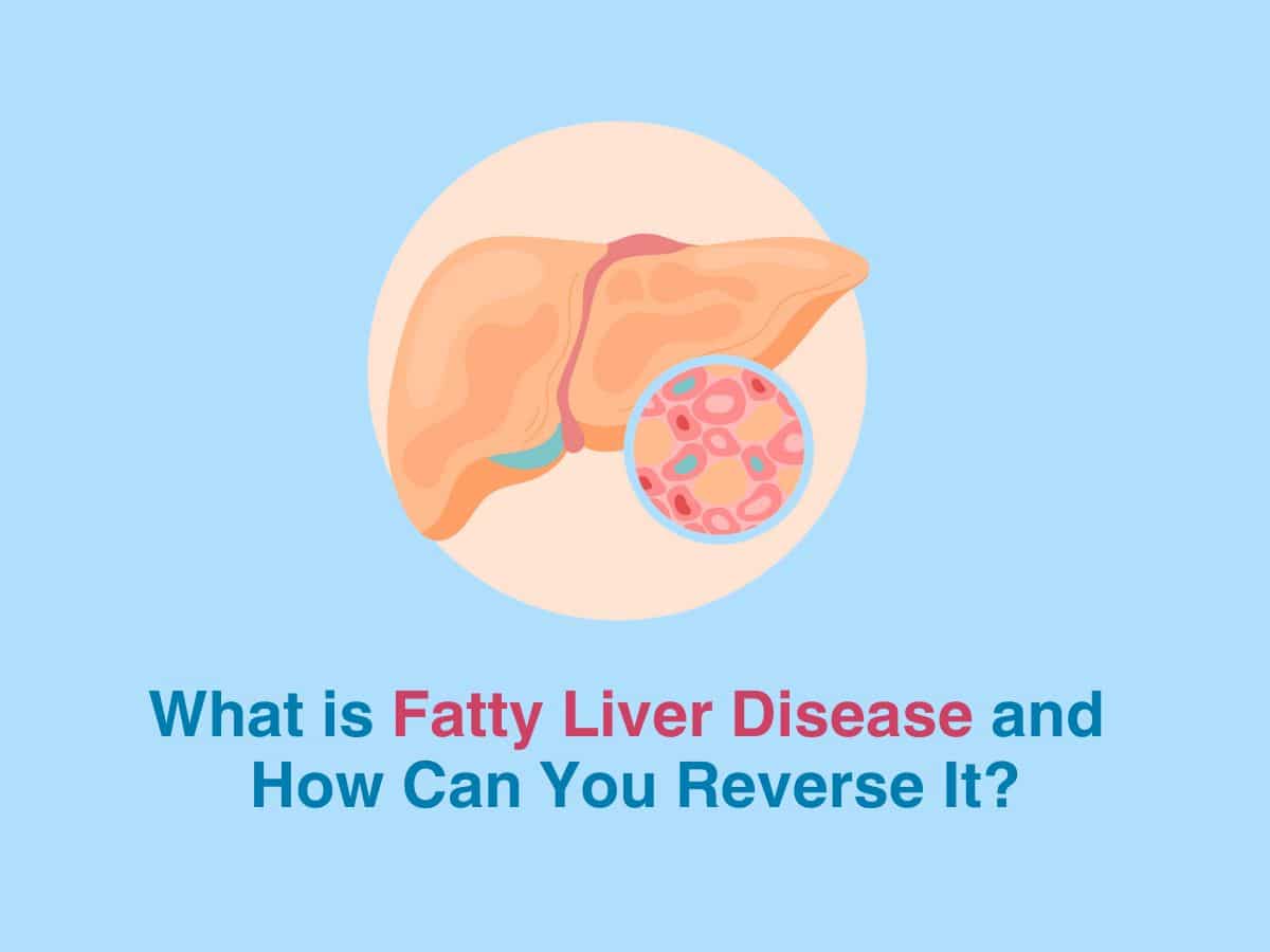 What is Fatty Liver Disease and How Can You Reverse It?