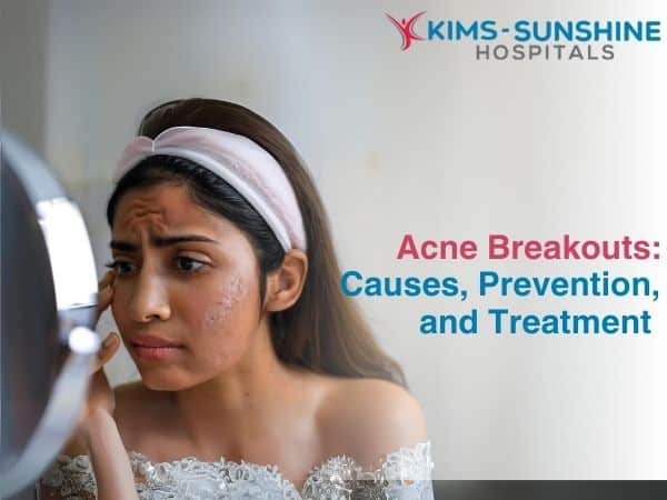 Acne Breakouts: Causes, Prevention, and Treatment