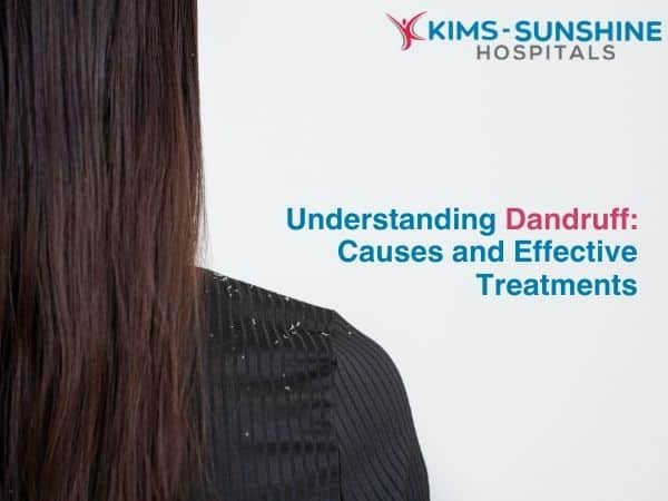 Understanding Dandruff: Causes and Effective Treatments