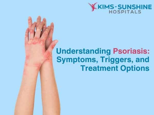 Understanding Psoriasis: Symptoms, Triggers, and Treatment Options