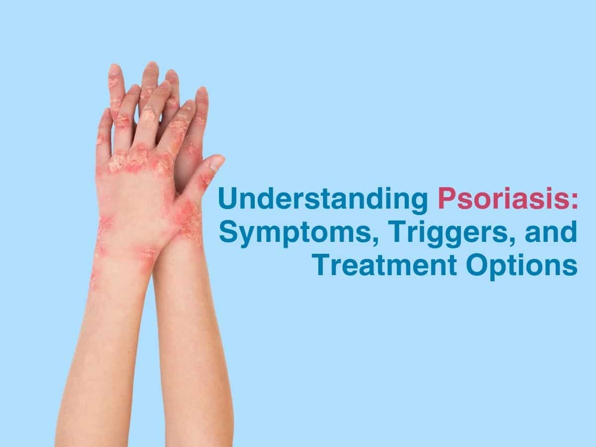 Understanding Psoriasis: Symptoms, Triggers, and Treatment Options