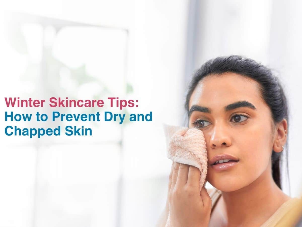 Winter Skincare Tips: How to Prevent Dry and Chapped Skin