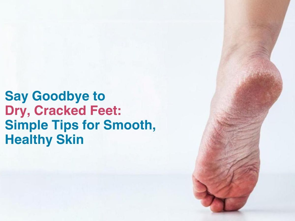 Say Goodbye to Dry, Cracked Feet: Simple Tips for Smooth, Healthy Skin