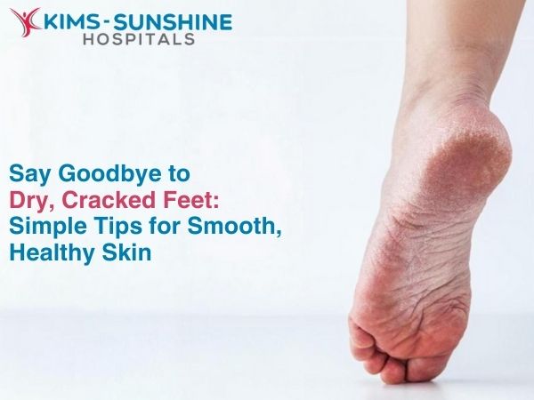 Say Goodbye to Dry, Cracked Feet: Simple Tips for Smooth, Healthy Skin