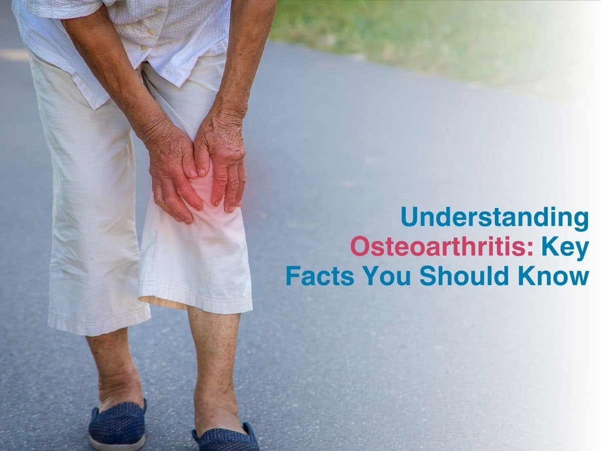 Understanding Osteoarthritis: Key Facts you Should Know