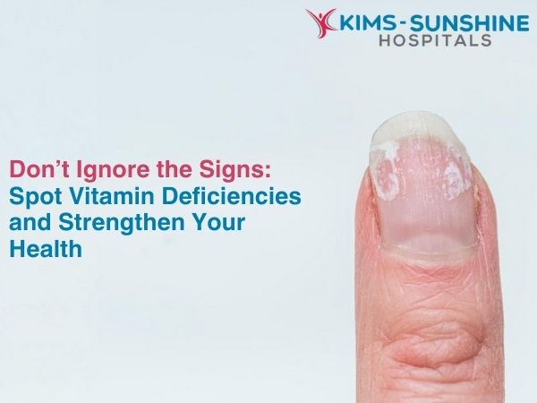 Don’t Ignore the Signs: Spot Vitamin Deficiencies and Strengthen Your Health