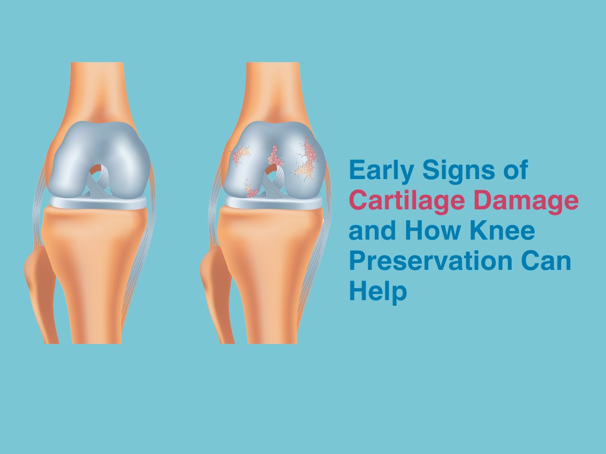 Early Indicators of Cartilage Damage and How Knee Preservation Can Help