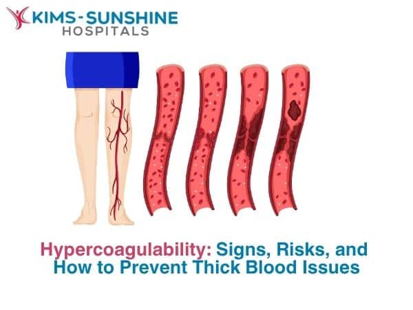 Hypercoagulability_ Signs, Risks, and How to Prevent Thick Blood Issues