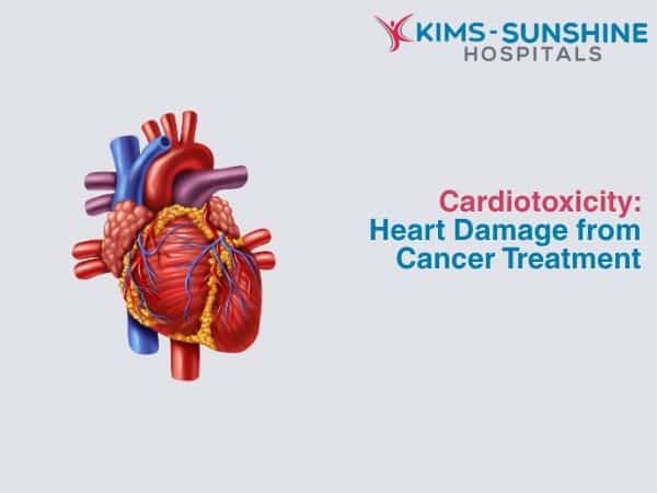 Cardiotoxicity: Heart Damage from Cancer Treatment