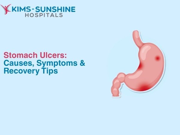 Stomach Ulcers_ Causes, Symptoms & Recovery Tips