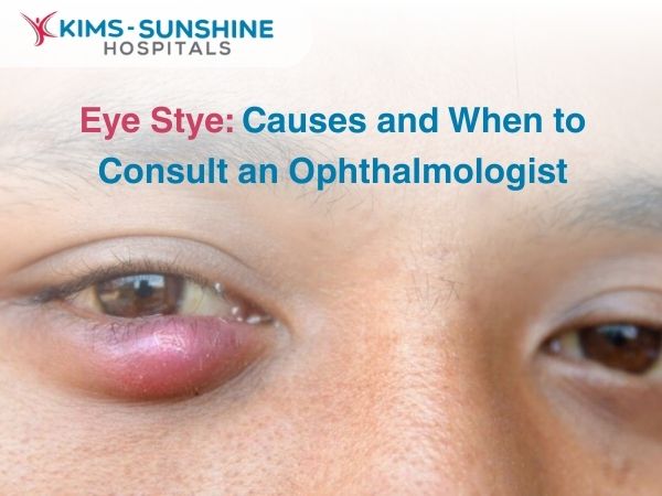 Eye Stye: Causes and When to Consult an Ophthalmologist