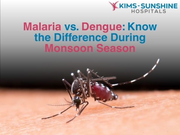 Aug-Malaria vs. Dengue_ Know the Difference During Monsoon Season