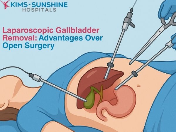July-Thumbnail -Laparoscopic Gallbladder Removal_ Advantages Over Open Surgery
