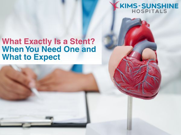 What Exactly Is a Stent? When You Need One and What to Expect