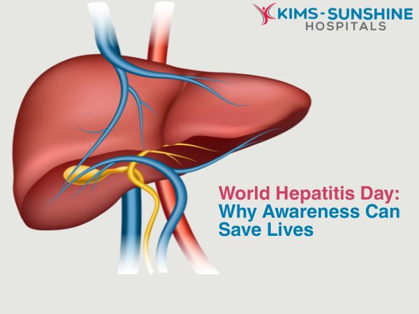 World Hepatitis Day: Why Awareness Can Save Lives