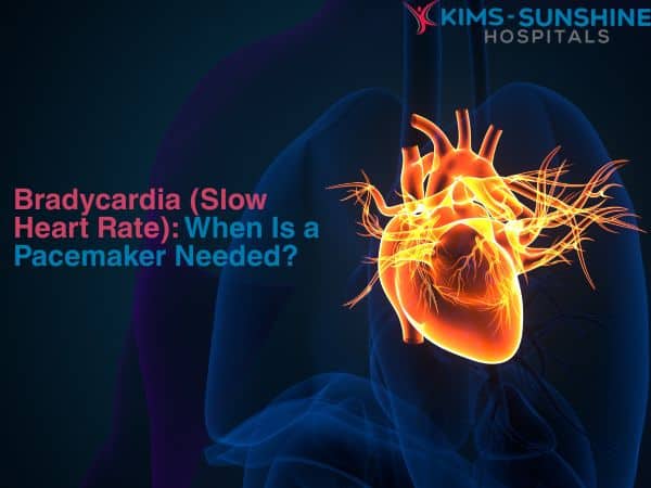 June-Thumbnail -Bradycardia (Slow Heart Rate)_ When Is a Pacemaker Needed