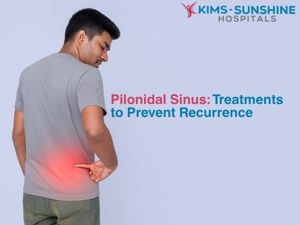 Pilonidal Sinus: Treatments to Prevent Recurrence