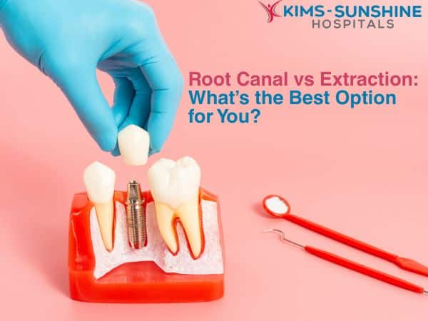 Root Canal vs Extraction: What’s the Best Option for You?
