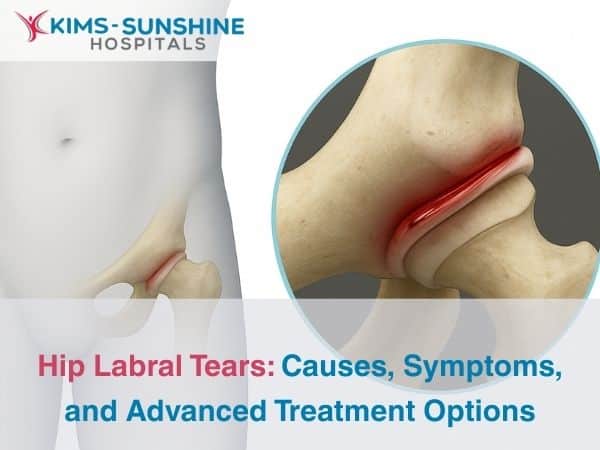 Hip Labral Tears_ Causes, Symptoms, and Advanced Treatment Options