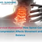 Oct-Cervical Myelopathy_ How Spinal Cord Compression Affects Movement and Balance