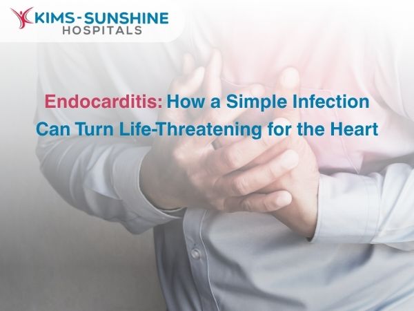 Oct-Endocarditis_ How a Simple Infection Can Turn Life-Threatening for the Heart