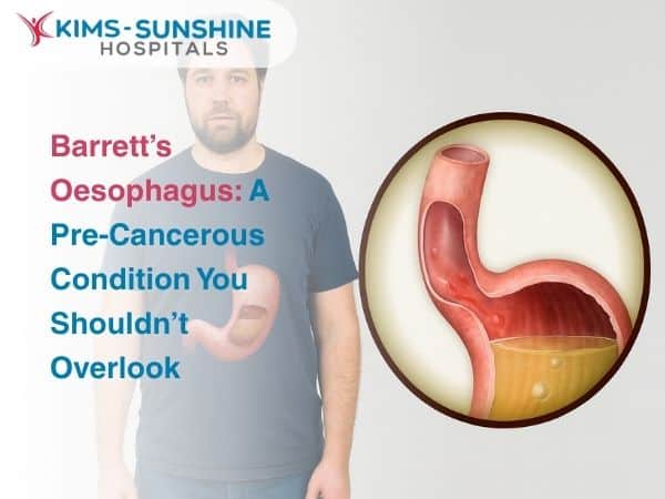 Oct-Barrett’s Oesophagus_ A Pre-Cancerous Condition You Shouldn’t Overlook