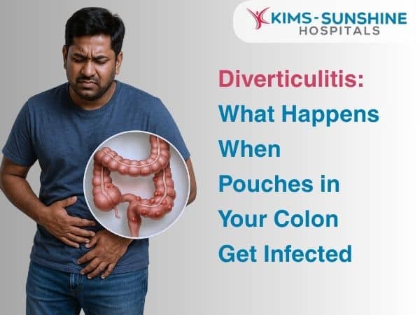 Oct-Diverticulitis_ What Happens When Pouches in Your Colon Get Infected